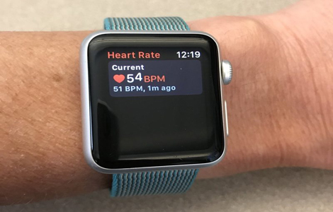 Heart-monitoring..In Apple Watch